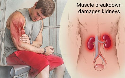 Thanh niên bị suy thận sau 2.000 lần 'đứng lên, ngồi xuống' để thắng cược- Ảnh 1. Thanh niên bị suy thận sau 2.000 lần 'đứng lên, ngồi xuống' để thắng cược- Ảnh 1.