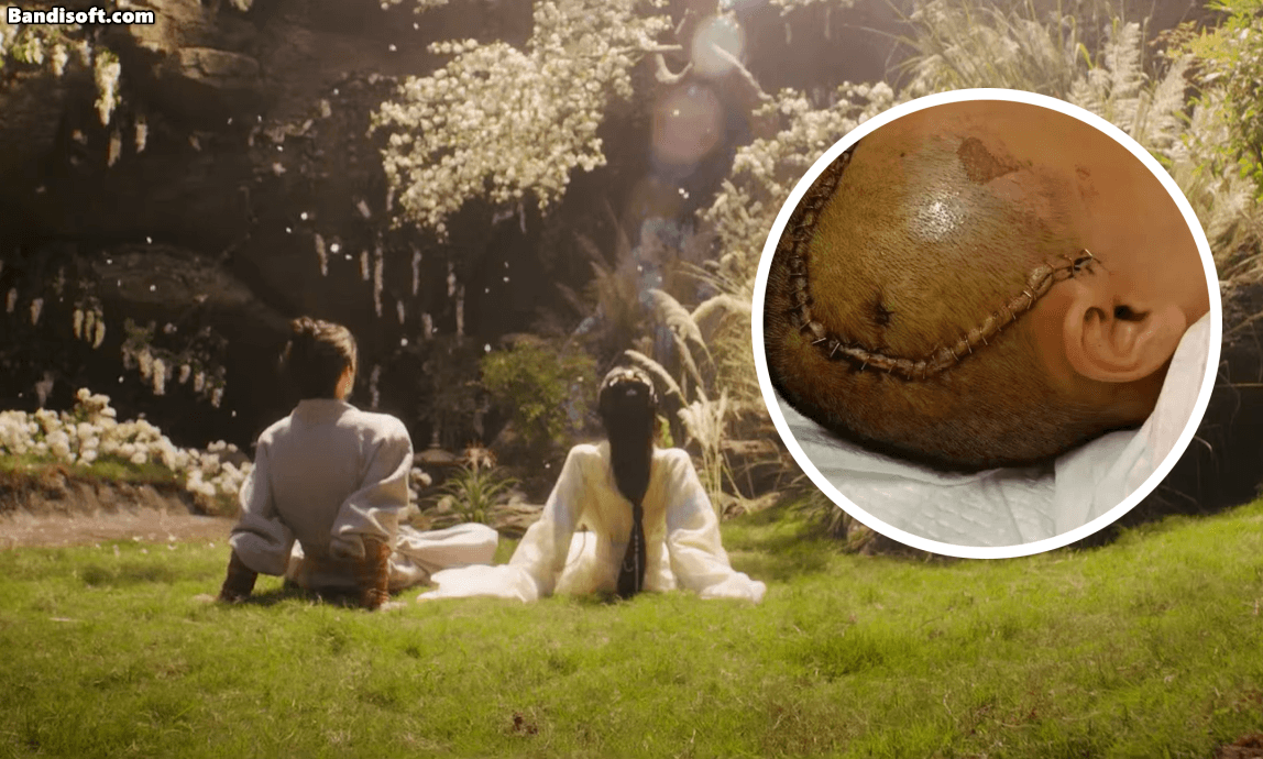 MXH náo loạn vì 1 nữ diễn viên bị tai nạn đến mất trí nhớ, 10 tháng đau đớn tưởng chết chẳng ai hay- Ảnh 1.