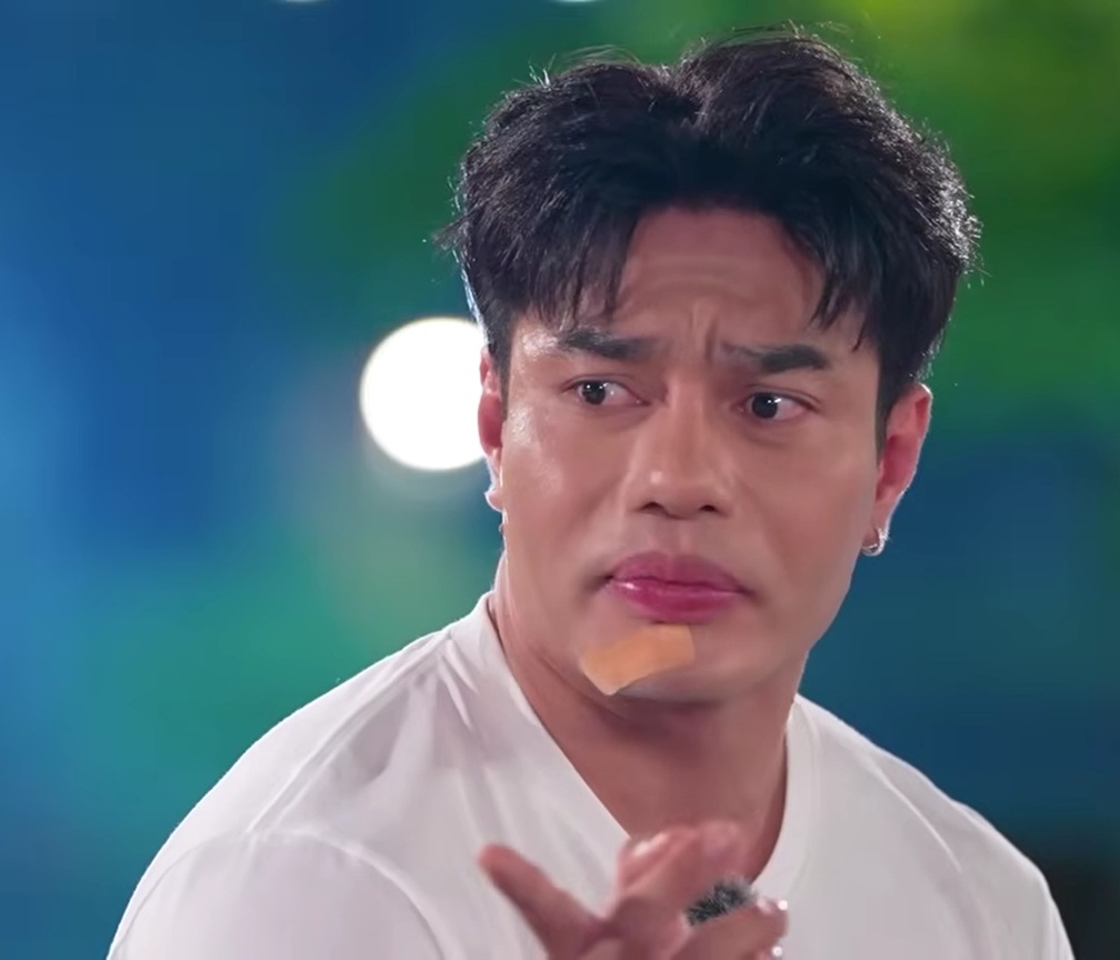 Nam diễn viên sửa mũi theo Lê Dương Bảo Lâm để nổi: Nam diễn viên sửa mũi theo Lê Dương Bảo Lâm để nổi: