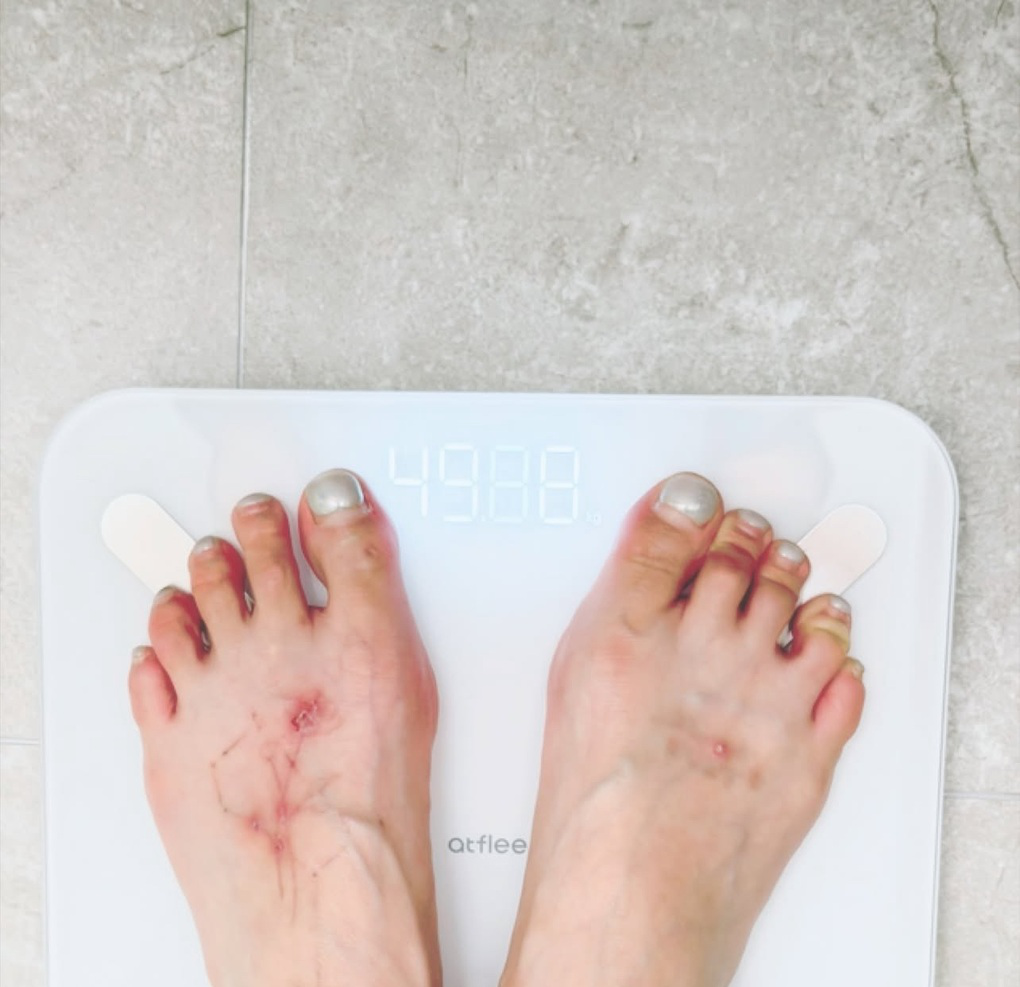 "Bóng ma" ngoại hình gầy trơ xương đã ám ảnh HyunA hyuna 3png 1762698217255 17628059584832118450814 1762870855555 17628708558342056881079