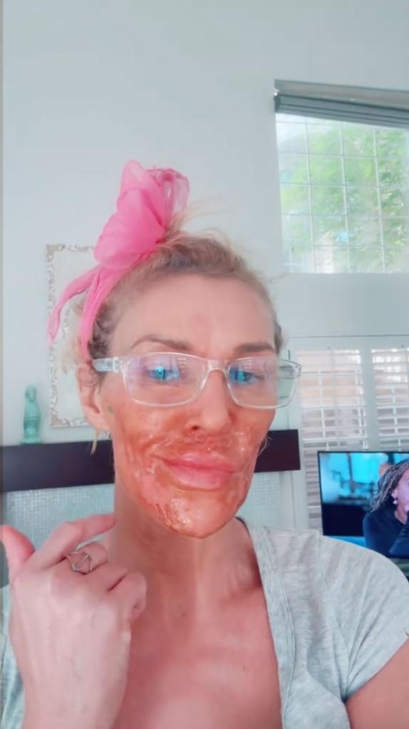 Nữ diễn viên mặt bị