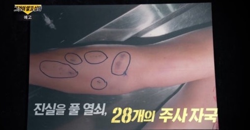 Cái chết của nam ca sĩ xứ Hàn trong khách sạn cao cấp vẫn còn là 1 bí ẩn chưa có lời giải- Ảnh 2.