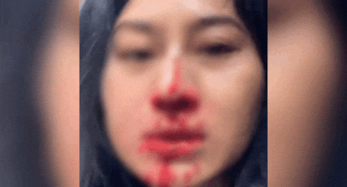 Diễn viên Phi Ngọc Ánh hoảng loạn cầu cứu- Ảnh 1.