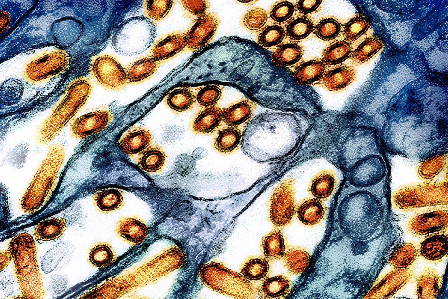 Phát hiện chủng virus cúm gia cầm chưa từng thấy ở người tại Mỹ- Ảnh 1.