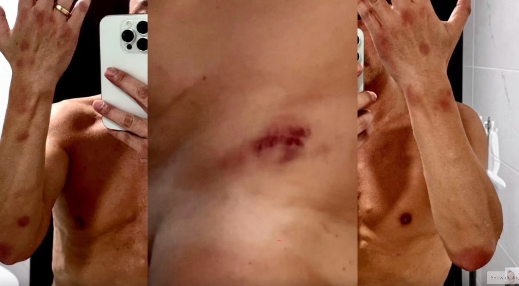 Vụ việc cực sốc: Nam diễn viên công khai hình ảnh bị chuốc thuốc và xâm hại tình dục tới mức suy thận- Ảnh 2.