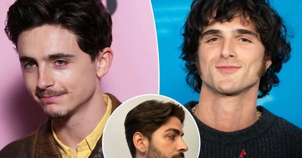 Sợ làm 'cụ già công sở', đàn ông đua nhau tiêm filler vào mặt 30 Sợ làm 'cụ già công sở', đàn ông đua nhau tiêm filler vào mặt jawline story hp 1 10453814 17403684055331371604139 0 14 432 705 crop 17403684218701768952259jpeg