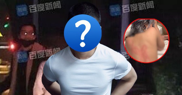 Nam thần 9x đẹp trai cool ngầu: Sự nghiệp bị ảnh hưởng vì những bê bối liên quan sở thích quái gở 28 Nam thần 9x đẹp trai cool ngầu: Sự nghiệp bị ảnh hưởng vì những bê bối liên quan sở thích quái gở khuat 174583450692649359851 0 0 500 800 crop 17458407975971600038157 1745862231073914212831 0 0 366 700 crop 1745862242252378727652jpg