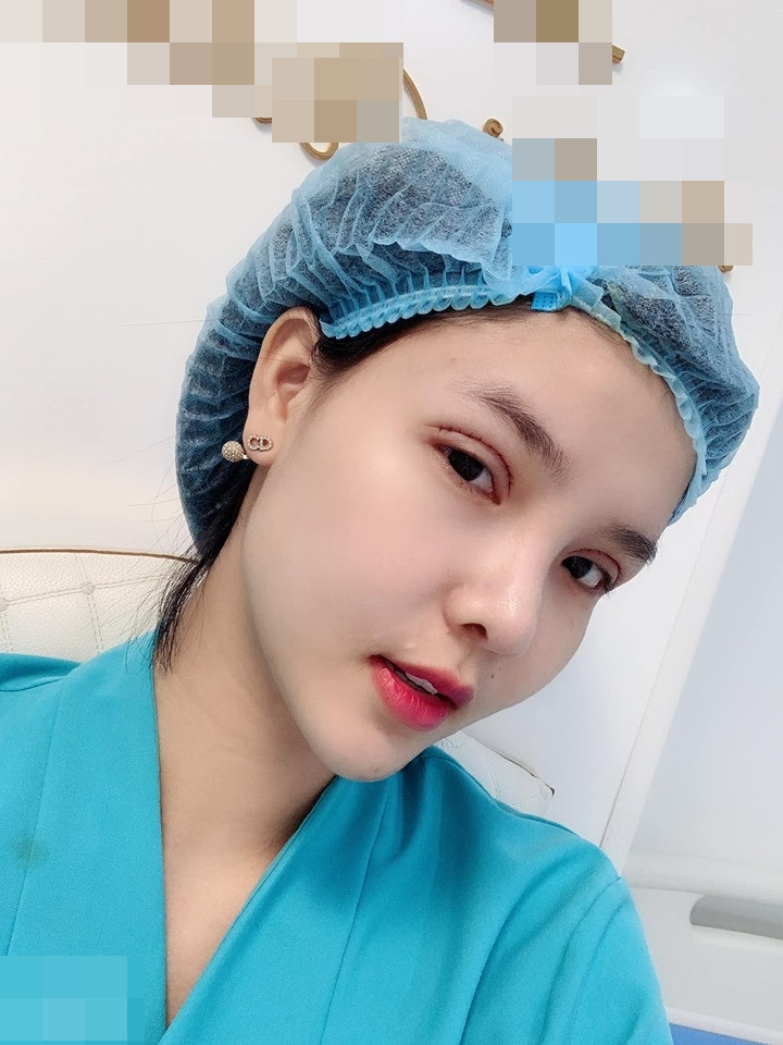 Người mẫu Việt tự khui ảnh thẩm mỹ mặt, thừa nhận rơi khủng hoảng vì sợ biến dạng vĩnh viễn- Ảnh 7. Người mẫu Việt tự khui ảnh thẩm mỹ mặt, thừa nhận rơi khủng hoảng vì sợ biến dạng vĩnh viễn- Ảnh 7.
