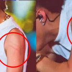 CĂNG: Ảnh cận vết rách da của Sơn Tùng khi bị khán giả "tấn công" giữa sân khấu l1 1744472210698774681297 0 0 251 480 crop 17444722318831604941098png