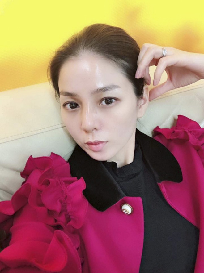 Phú bà Vbiz ở biệt thự hàng trăm tỷ suýt bị hoại tử vì phẫu thuật thẩm mỹ, phải huỷ show tháo sụn mũi gấp- Ảnh 3.