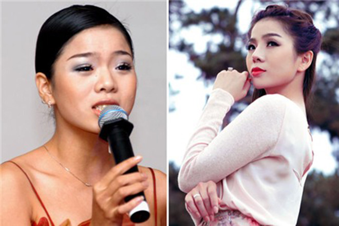 Phú bà Vbiz ở biệt thự hàng trăm tỷ suýt bị hoại tử vì phẫu thuật thẩm mỹ, phải huỷ show tháo sụn mũi gấp- Ảnh 2.