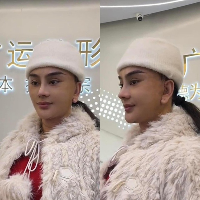 Sao nữ Vbiz bị hải quan giữ lại vì mặt lạ hoắc sau khi phẫu thuật thẩm mỹ, thừa nhận sức khỏe yếu đi rõ rệt- Ảnh 7.