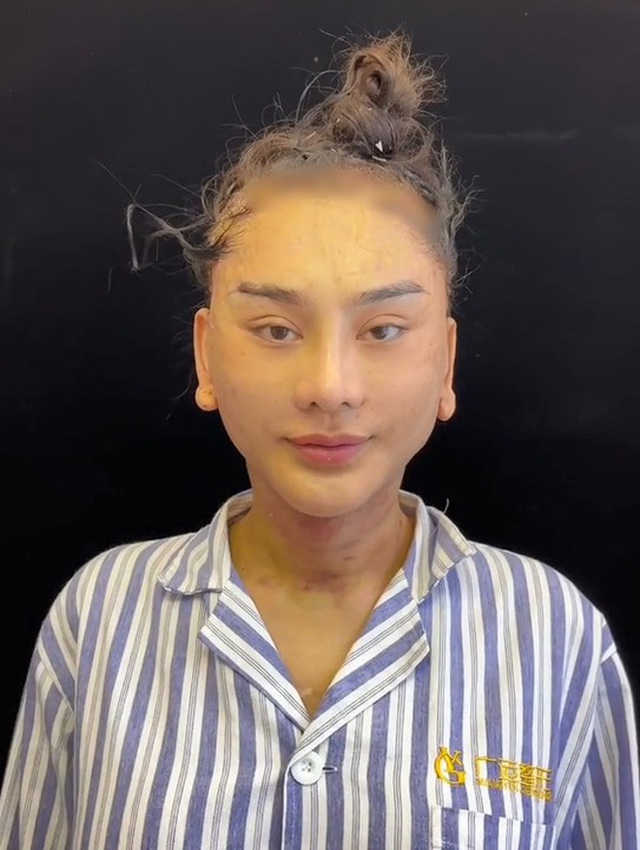 Sao nữ Vbiz bị hải quan giữ lại vì mặt lạ hoắc sau khi phẫu thuật thẩm mỹ, thừa nhận sức khỏe yếu đi rõ rệt- Ảnh 5.