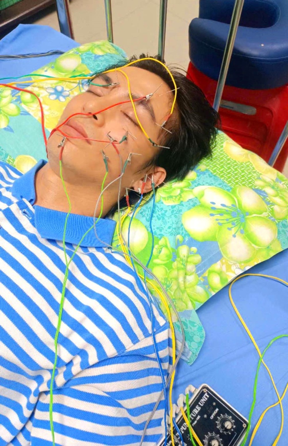 Sao nam Vbiz vừa bị liệt dây thần kinh số 7 hé lộ triệu chứng báo hiệu căn bệnh, cảnh báo việc không nên làm- Ảnh 1.