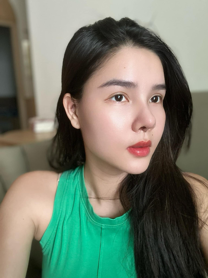 Người mẫu Việt tự khui ảnh thẩm mỹ mặt, thừa nhận rơi khủng hoảng vì sợ biến dạng vĩnh viễn- Ảnh 8. Người mẫu Việt tự khui ảnh thẩm mỹ mặt, thừa nhận rơi khủng hoảng vì sợ biến dạng vĩnh viễn- Ảnh 8.