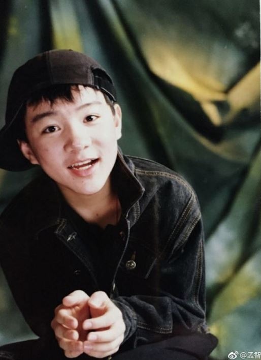 m2-1615274427602449522494-1755849756288653138898-1755864162120-1755864162502344127048 "Sao nhí số 1 showbiz" 14 tuổi đầu không còn 1 sợi tóc, khổ sở chịu đựng 300 mũi kim để cứu diện mạo m2 1615274427602449522494 1755849756288653138898 1755864162120 1755864162502344127048