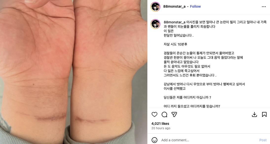 Sốc: Chủ nhân “bản hit quốc dân” cố tự tử- Ảnh 2.