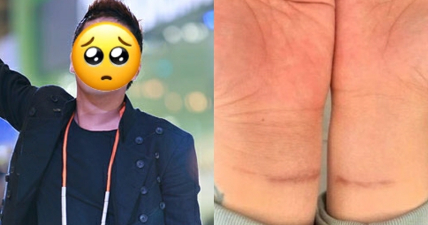 Sốc: Chủ nhân “bản hit quốc dân” cố tự tử mc71 17630928515741835239854 119 0 2004 3600 crop 17630928704592053412787jpg