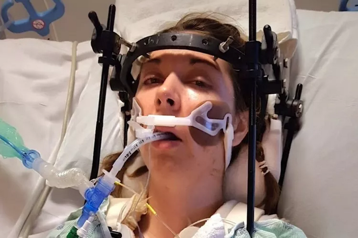 Bị 'rụng đầu khỏi cổ', người phụ nữ trải qua 37 ca phẫu thuật để giữ tính mạng- Ảnh 1. Bị 'rụng đầu khỏi cổ', người phụ nữ trải qua 37 ca phẫu thuật để giữ tính mạng- Ảnh 1.