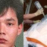 83 ngày cuối đời đau đớn của người nhiễm phóng xạ nặng nhất lịch sử nhân loại nan nhan 22173076 1739417876747 17394178772101970392103 55 0 505 720 crop 17394179022191874748912jpg