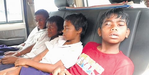 8 học sinh suýt mù vĩnh viễn vì bị bạn cùng phòng nhỏ keo dán vào mắt khi đang ngủ- Ảnh 1.