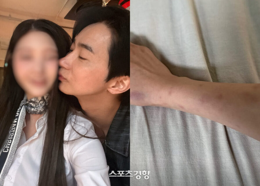 Nam diễn viên hàng đầu bất ngờ bị tố bạo hành,