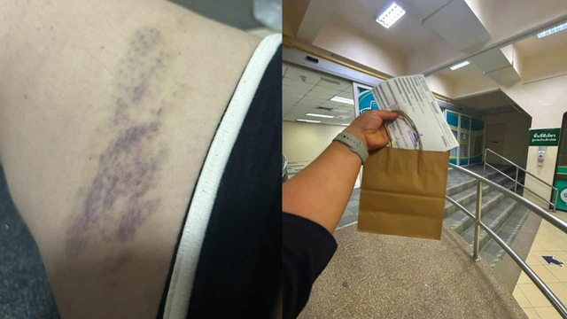 Đang ngồi bán hàng ở ven đường, cô gái nghe thấy tiếng động lớn, nhìn lên thì lập tức bỏ chạy- Ảnh 3.