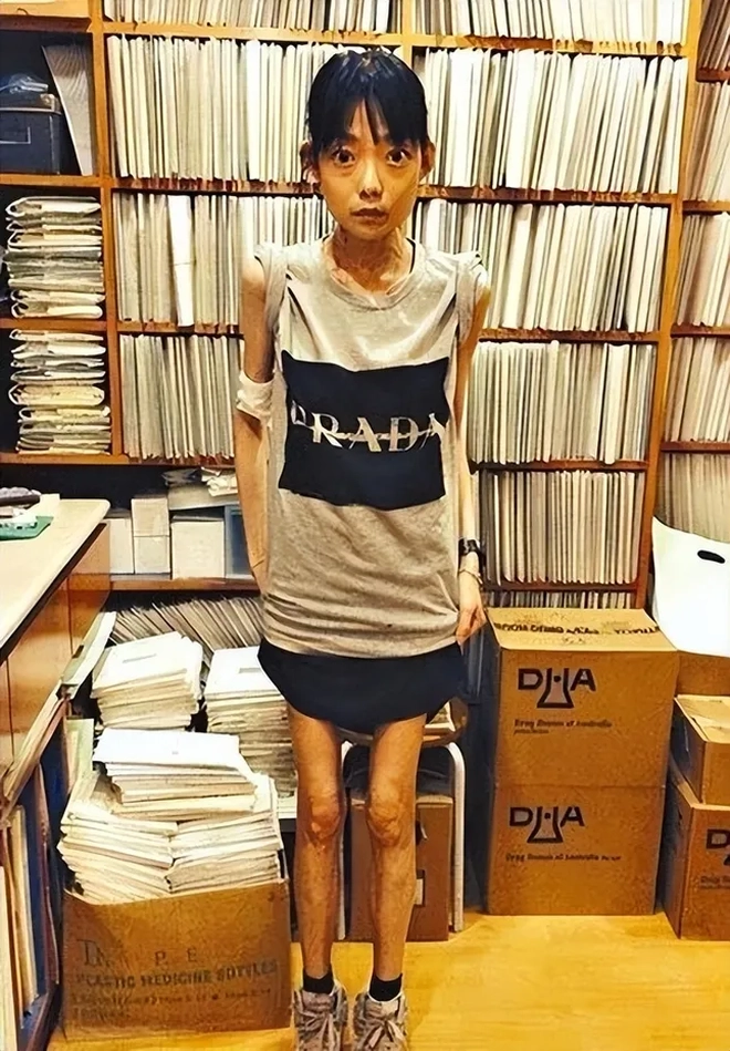 Mỹ nhân Hong Kong chỉ nặng 22 kg- Ảnh 3.