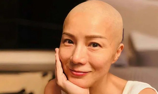 Bi kịch của Á hậu Hong Kong mắc ung thư - 1