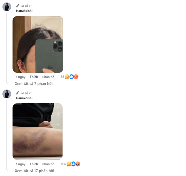 Nữ streamer xinh đẹp tiết lộ bị