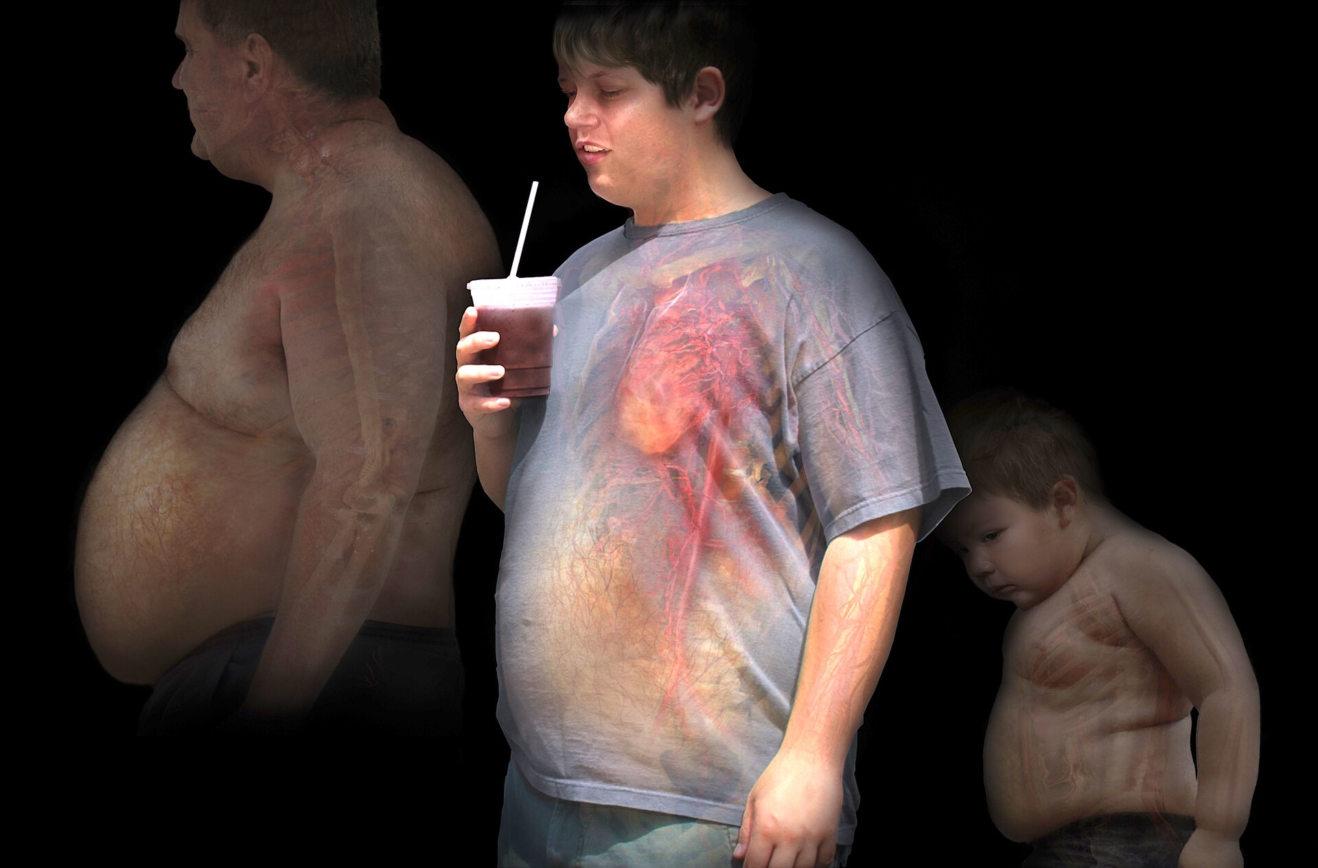 Phát hiện căn bệnh lạ, có thể gây ra cơn đói không thể kiểm soát- Ảnh 2.