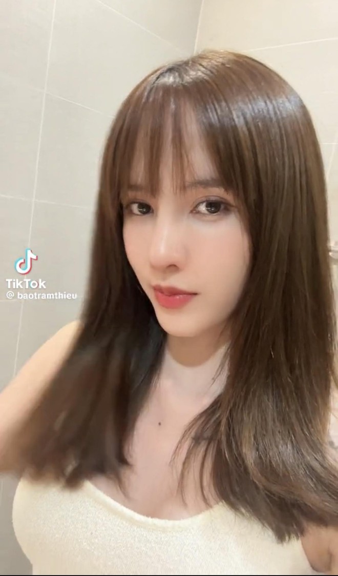 Thiều Bảo Trâm phẫu thuật thẩm mỹ- Ảnh 7.