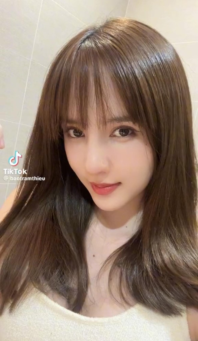 Thiều Bảo Trâm phẫu thuật thẩm mỹ- Ảnh 6.