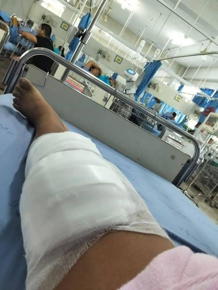 Bị rắn hổ mang chúa cắn khi hái nấm, người phụ nữ dùng tay không đánh chết rồi xách đến bệnh viện, bác sĩ choáng váng- Ảnh 2.