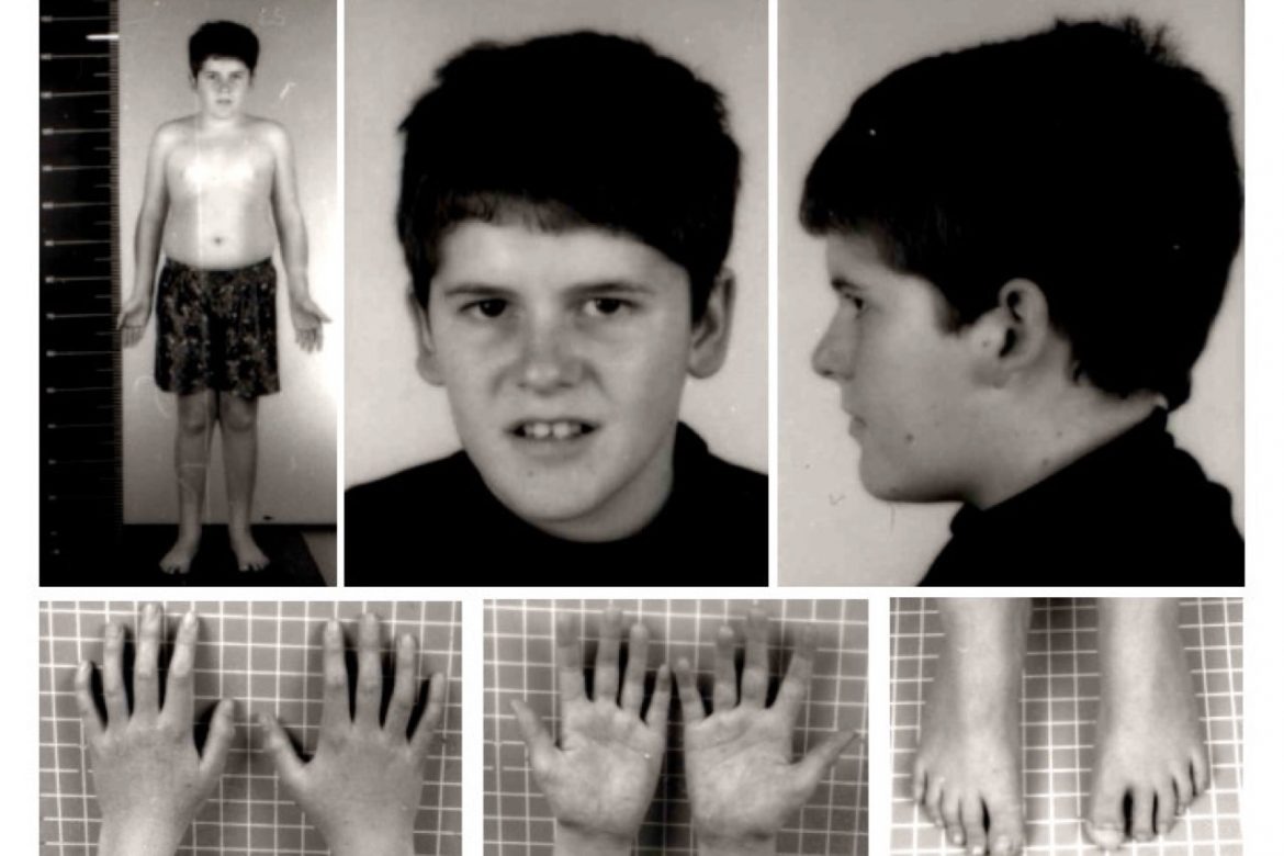 Phát hiện căn bệnh lạ, có thể gây ra cơn đói không thể kiểm soát- Ảnh 1.