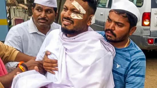 Tình hình hiện tại của người sống sót duy nhất trong thảm kịch máy bay Air India sau 3 tháng- Ảnh 2. Tình hình hiện tại của người sống sót duy nhất trong thảm kịch máy bay Air India sau 3 tháng- Ảnh 2.