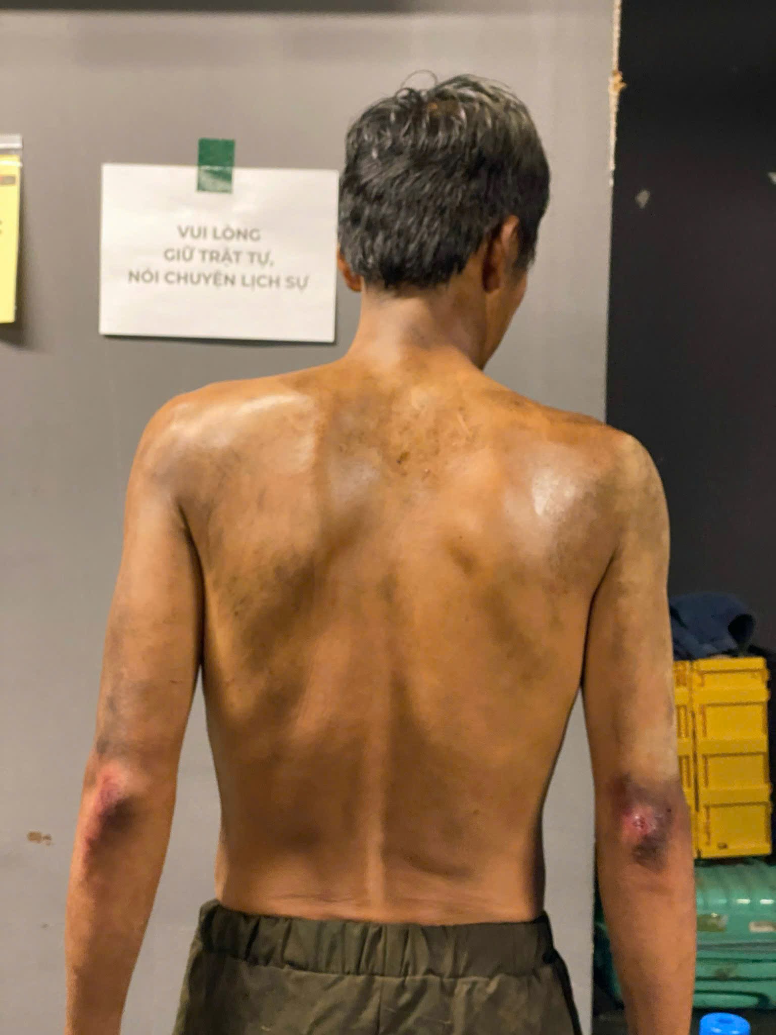 Nhận không ra sao nam trong bom tấn Địa Đạo: Ép cân 14 kg đến mức gầy trơ xương, visual hiện tại mới gây sốc- Ảnh 3.