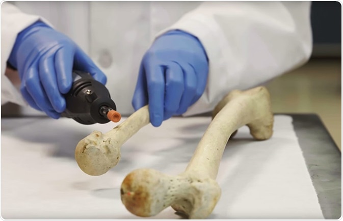 DNA được sử dụng như thế nào để xác định nạn nhân trong các thảm họa hàng loạt?- Ảnh 3.