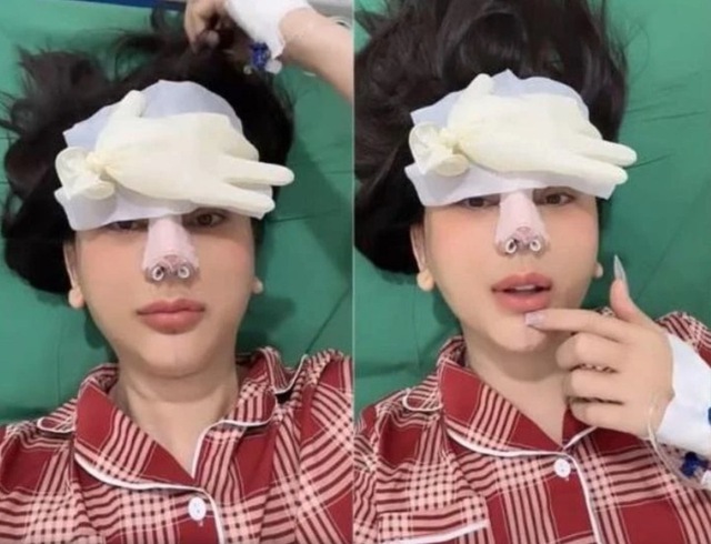 Sao nữ Vbiz bị hải quan giữ lại vì mặt lạ hoắc sau khi phẫu thuật thẩm mỹ, thừa nhận sức khỏe yếu đi rõ rệt- Ảnh 3.