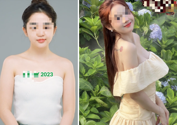 Nữ streamer lột xác sau trùng tu vòng 1, bất ngờ