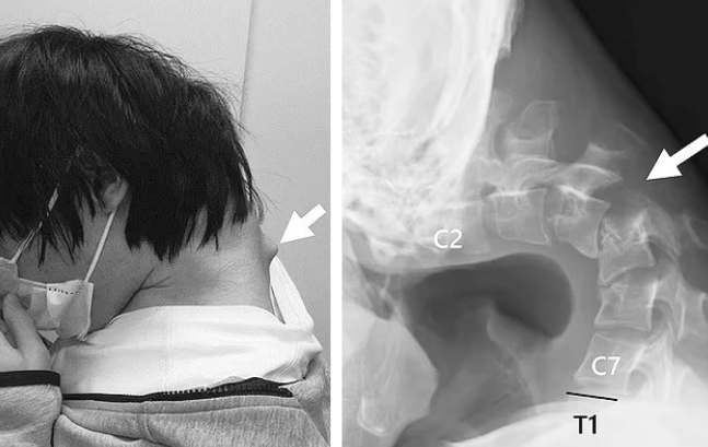 Những hình ảnh đáng sợ của việc chơi game không khoa học, cảnh báo cho game thủ- Ảnh 2. Những hình ảnh đáng sợ của việc chơi game không khoa học, cảnh báo cho game thủ- Ảnh 2.