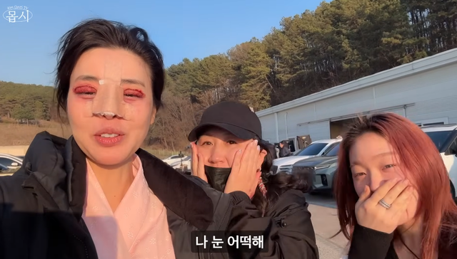 Mỹ nhân Giày Thủy Tinh gây sốc với gương mặt sưng tấy đáng sợ, băng bó kín mít- Ảnh 3.