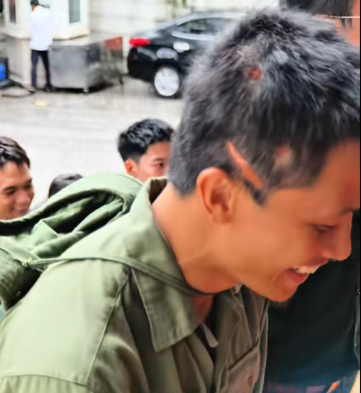 Màn huỷ dung sốc nhất Mưa Đỏ: Ngoài đời là cực phẩm nam thần, lên phim đầu chi chít sẹo nhìn mà choáng- Ảnh 5.