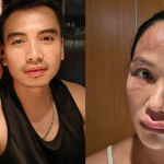 Hoa hậu H'Hen Niê sau khi bị biến dạng mặt screenshot17 17613834724321103937121 0 0 608 1161 crop 1761383515758982185719png