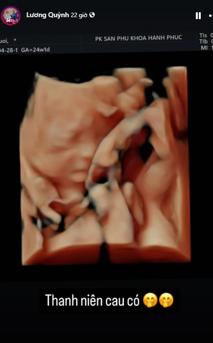 Mẹ bầu Vbiz ám ảnh sau khi làm xét nghiệm: Bị choáng váng đầu óc, nằm 2 tiếng không thở nổi- Ảnh 2.