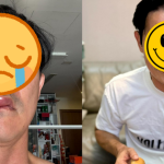 Sao nam Vbiz hoảng hốt vì bị biến dạng mặt: Hé lộ tình trạng nghiêm trọng hiện tại screenshot3 17436680831742110934690 0 0 557 1063 crop 17436680982471938536547png