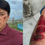 Quách Ngọc Tuyên bị tai nạn screenshot3 17618824420721556089161 0 0 592 1130 crop 17618825241421366033388png