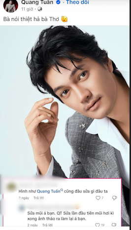 Sao nam Running Man Việt phẫu thuật hỏng, phải sửa lại mũi gấp?- Ảnh 2.