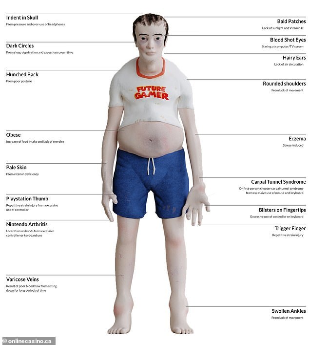 Những hình ảnh đáng sợ của việc chơi game không khoa học, cảnh báo cho game thủ- Ảnh 3. Những hình ảnh đáng sợ của việc chơi game không khoa học, cảnh báo cho game thủ- Ảnh 3.