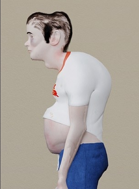 Những hình ảnh đáng sợ của việc chơi game không khoa học, cảnh báo cho game thủ- Ảnh 6. Những hình ảnh đáng sợ của việc chơi game không khoa học, cảnh báo cho game thủ- Ảnh 6.